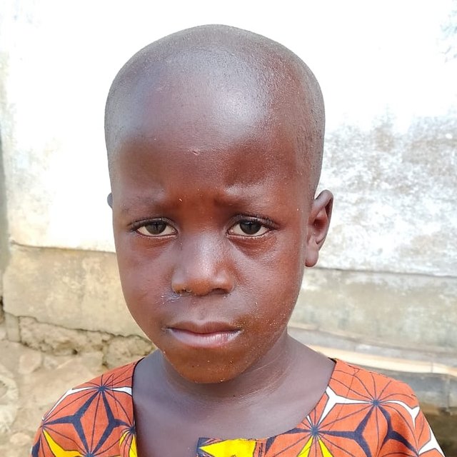 Abraham K., age 6, in Malema, Liberia