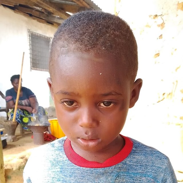 Mohammed D., age 3, in Malema, Liberia